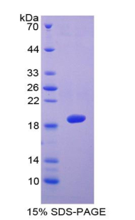 血小板反应蛋白解整合素金属肽酶5(ADAMTS5)重组蛋白