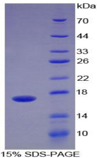 血小板反应蛋白解整合素金属肽酶4(ADAMTS4)重组蛋白