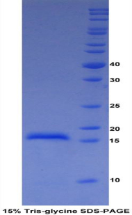 血小板反应蛋白解整合素金属肽酶2(ADAMTS2)重组蛋白