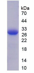 血小板反应蛋白2(THBS2)重组蛋白