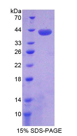 序列相似家族135成员B(FAM135B)重组蛋白