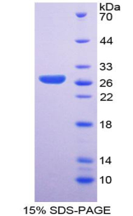 性别决定区Y框蛋白2(SOX2)重组蛋白