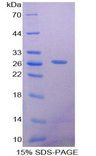 性别决定区Y框蛋白18(SOX18)重组蛋白