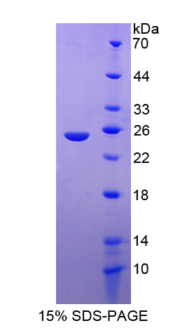 形成素结合蛋白1(FNBP1)重组蛋白