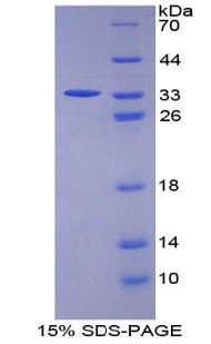 信号转导衔接分子1(STAM1)重组蛋白