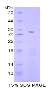 信号传导转录激活因子4(STAT4)重组蛋白