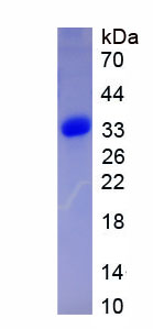 信号传导转录激活因子2(STAT2)重组蛋白