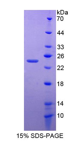 锌指同源框蛋白4(ZFHX4)重组蛋白