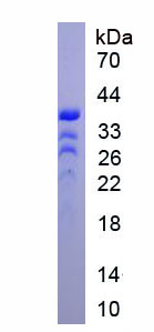 锌指同源框蛋白1B(ZFHX1B)重组蛋白