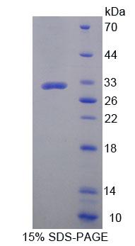 锌指蛋白10(ZNF10)重组蛋白