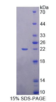 心肌细胞特异性增强因子2A(MEF2A)重组蛋白