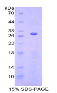 心肌肌动蛋白α1(ACTC1)重组蛋白