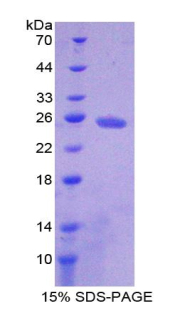 腺苷酸环化酶4(ADCY4)重组蛋白