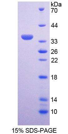 细胞周期素D3(CCND3)重组蛋白