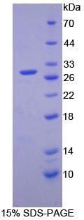 细胞周期素D2(CCND2)重组蛋白
