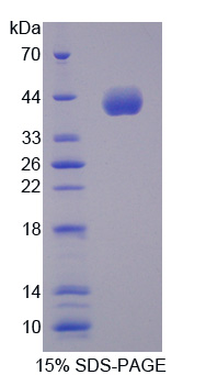 细胞周期素B2(CCNB2)重组蛋白