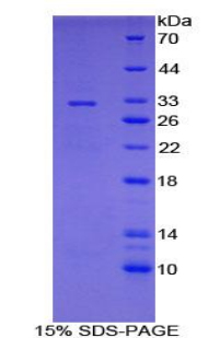 细胞色素P450家族成员7A1(CYP7A1)重组蛋白