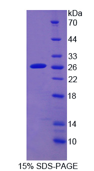 细胞色素P450家族成员2D6(CYP2D6)重组蛋白