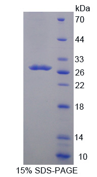 细胞色素P450家族成员24A1(CYP24A1)重组蛋白