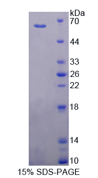 细胞色素P450家族成员11B1(CYP11B1)重组蛋白