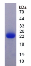 细胞色素C氧化酶亚基Ⅳ亚型1(COX4I1)重组蛋白