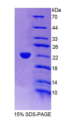 细胞色素C氧化酶亚基Ⅲ(COX3)重组蛋白