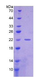 细胞角蛋白19片段抗原21-1(CYFRA21-1)重组蛋白