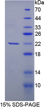 细胞分裂周期因子25(CDC25)重组蛋白