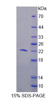 细胞程序性死亡蛋白6(PDCD6)重组蛋白