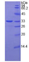 硒蛋白P1(SEPP1)重组蛋白