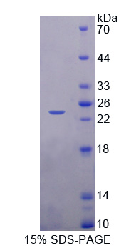 无刚毛鳞甲复合体样蛋白1(ASCL1)重组蛋白