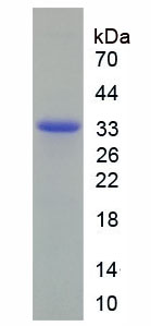 无翅型MMTV整合位点家族成员7B(WNT7B)重组蛋白