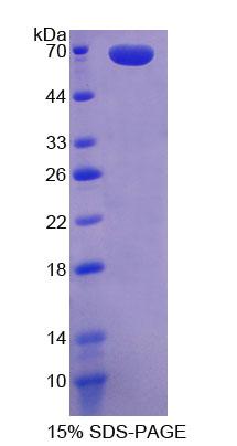 无翅型MMTV整合位点家族成员2B(WNT2B)重组蛋白