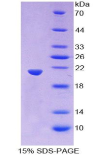 无翅型MMTV整合位点家族成员11(WNT11)重组蛋白