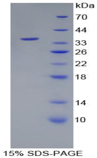 无翅型MMTV整合位点家族成员10B(WNT10B)重组蛋白