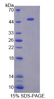 胃动蛋白1(GKN1)重组蛋白