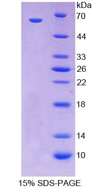 尾型同源框转录因子2(CDX2)重组蛋白