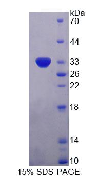 围脂滴蛋白4(PLIN4)重组蛋白