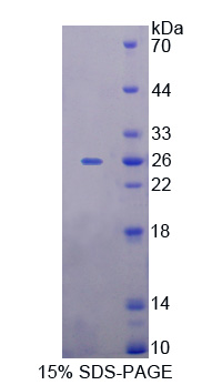 微小染色体维持缺陷蛋白5(MCM5)重组蛋白