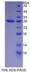 微小染色体维持缺陷蛋白2(MCM2)重组蛋白