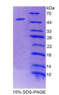 微纤丝关联蛋白2(MFAP2)重组蛋白