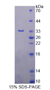 微管关联蛋白RP/EB家族成员1(MAPRE1)重组蛋白