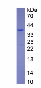 唾液富组蛋白3(HTN3)重组蛋白