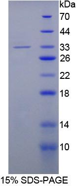 拓扑异构酶Ⅱ(TOP2)重组蛋白