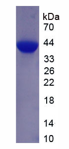 拓扑异构酶Ⅰ(TOP1)重组蛋白