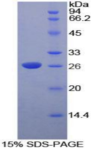 脱氧核糖核酸酶Ⅰ样2(DNASE1L2)重组蛋白