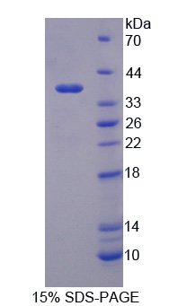 突触蛋白Ⅰ(SYN1)重组蛋白