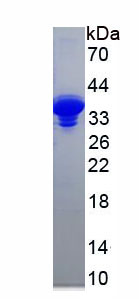 铜蓝蛋白(CP)重组蛋白