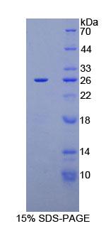 糖抗原125(CA125)重组蛋白