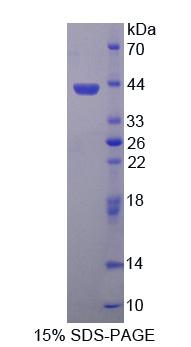 羰基还原酶3(CBR3)重组蛋白